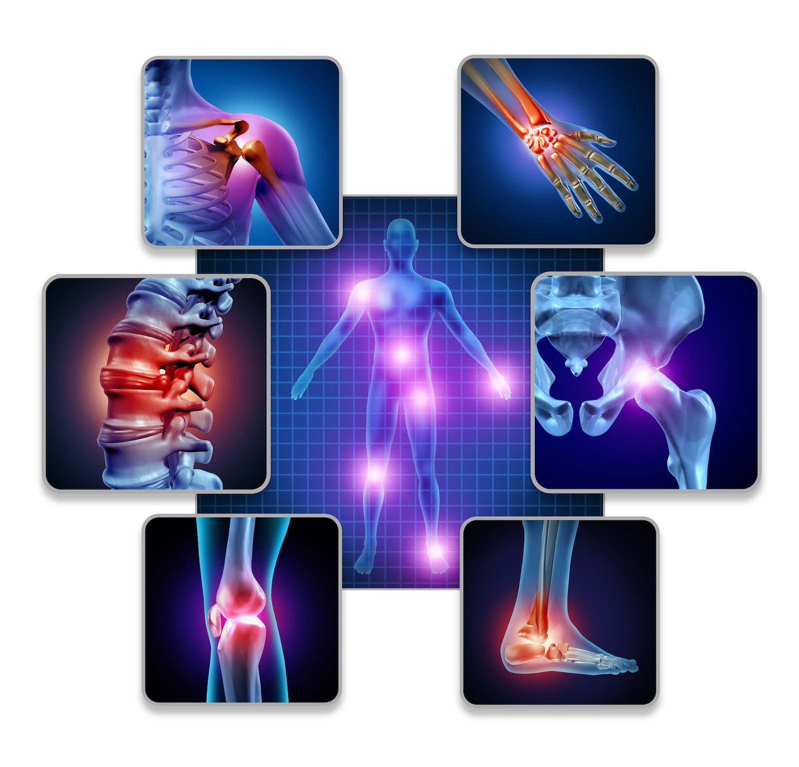 Human Body Joint Pain Diagram