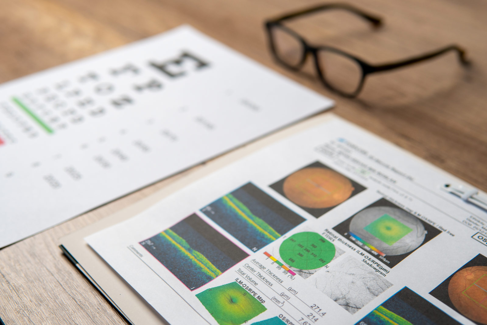 OCT Vision Test for Plaquenil Toxicity to help Prevent Blindness